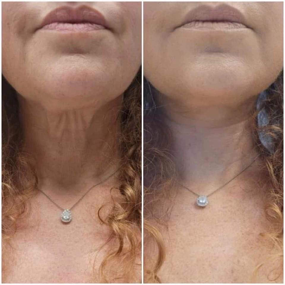 Firming Cream + Pearls Bundle