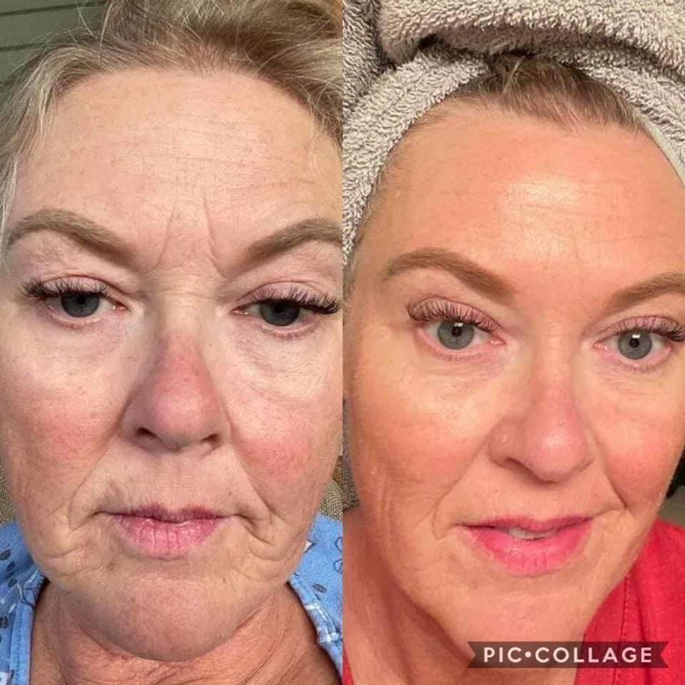 Firming Cream & Uplifting Cream Bundle