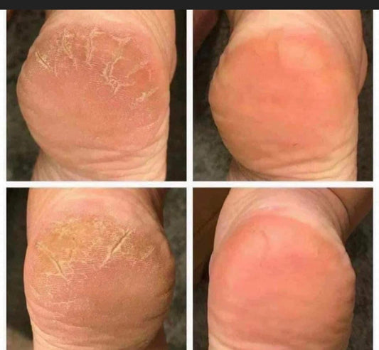 Sole Solution